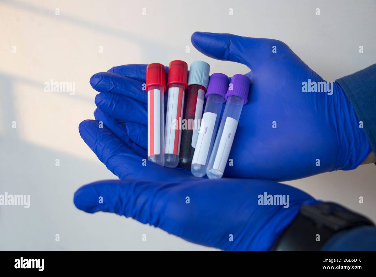 Primer plano de una mano que sostiene un tubo de ensayo lleno de sangre Foto de stock