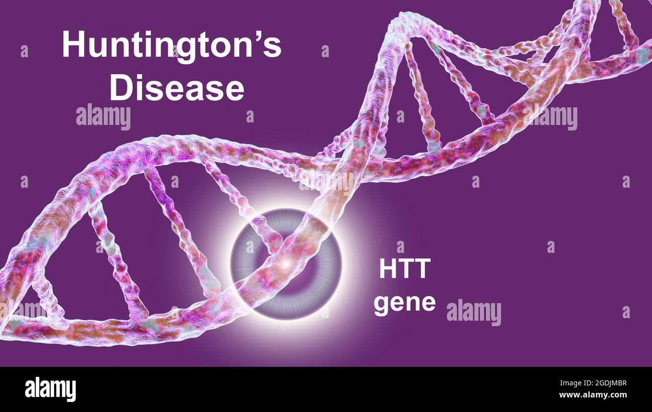 Enfermedad de huntington fotografías e imágenes de alta