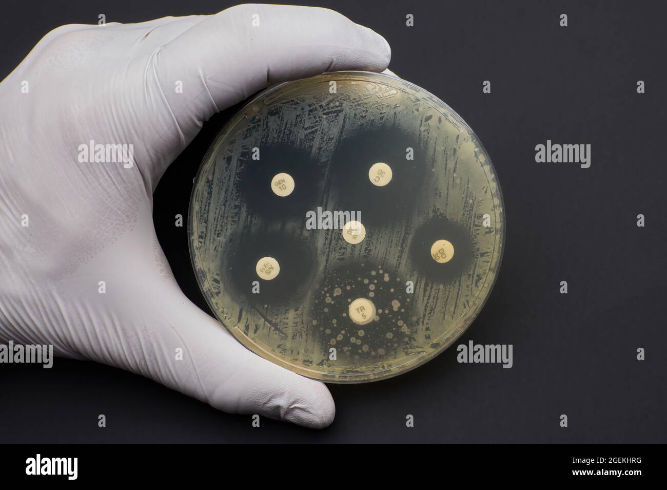 Prueba de susceptibilidad antimicrobiana por prueba de difusión de fondo negro de placa de Petri Foto de stock