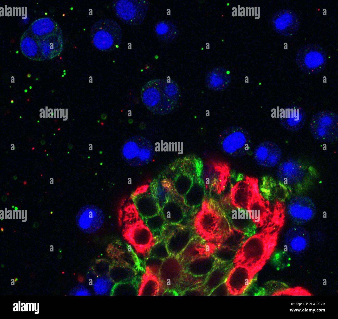 Organoide mamario con células migratorias. Foto de stock