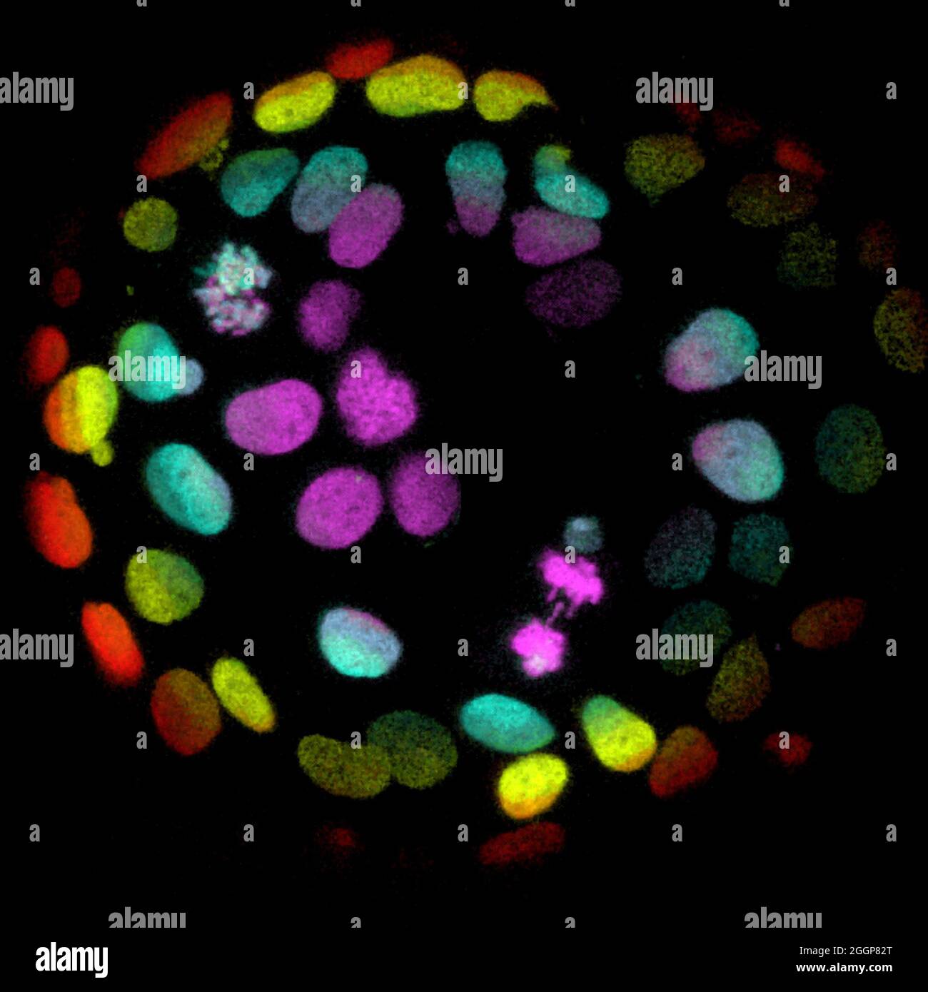 Imagen microscópica de células colorrectales crecidas en organoides. Foto de stock