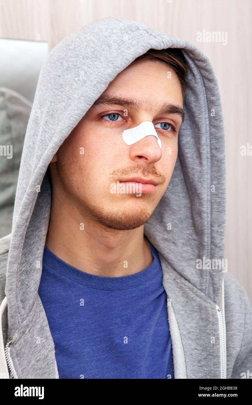 Hombre con la nariz rota fotografías e imágenes de alta resolución