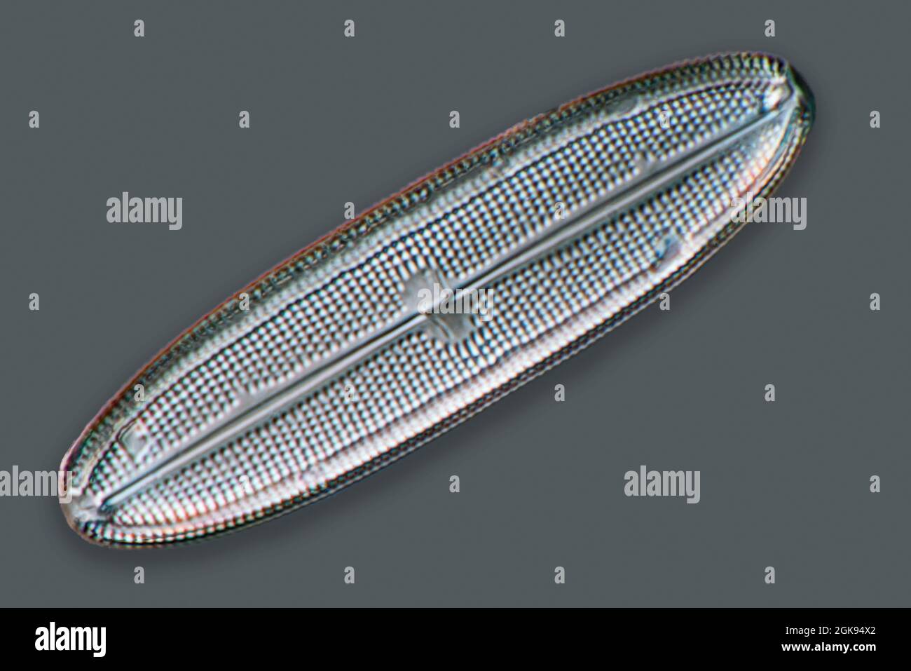 Diatom (Diatomeae), diatomeas de Marienwerden, microscopía de contraste de  interferencia diferencial, ampliación x 140 relacionada con una impresión  de 35 mm, Alemania Fotografía de stock - Alamy