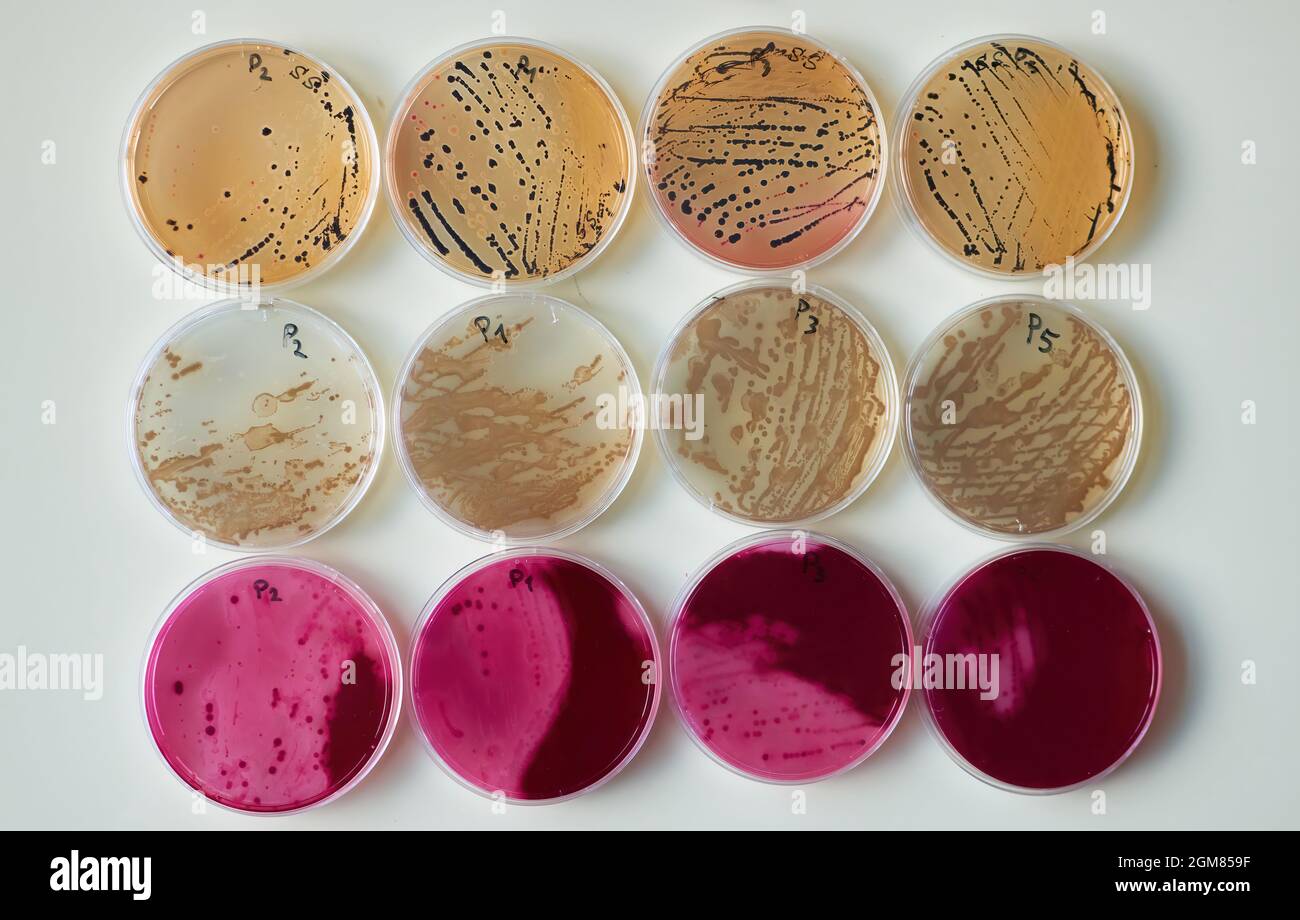 Medios selectivos Placas de agar con colonias de bacterias en varios platos  de Petri Fotografía de stock - Alamy