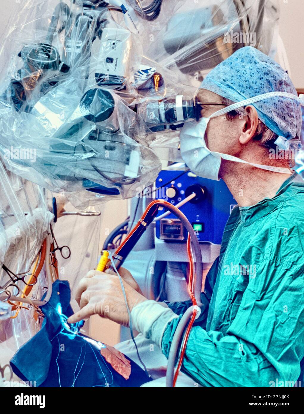 El neurocirujano realiza una microcirugía para la extirpación del tumor cerebral. Foto de stock