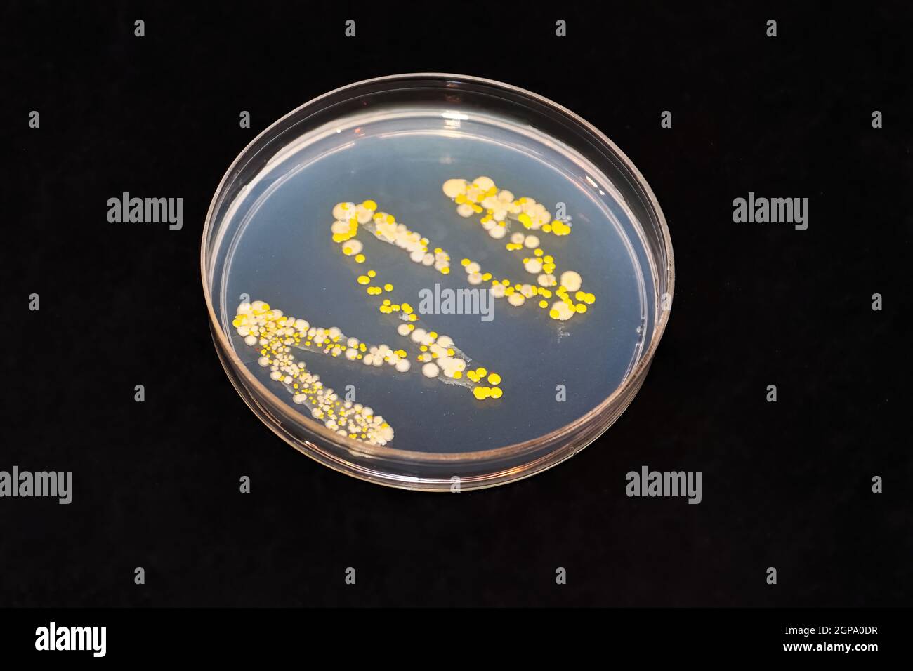 Un agar con bacterias y hongos colonias contra el negro Fotografía de stock  - Alamy