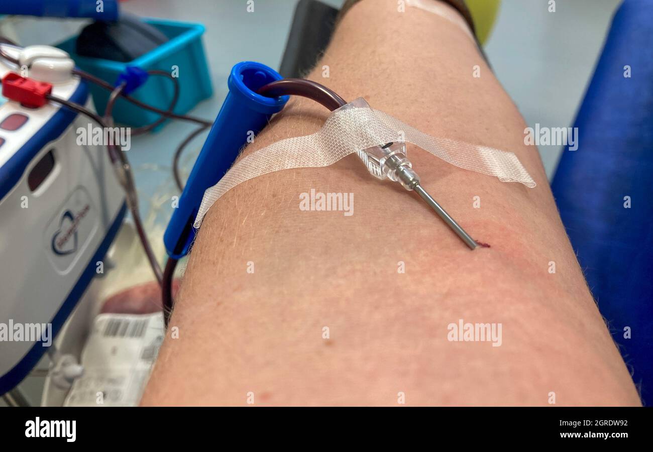 Un donante de sangre da sangre en un centro de donación de sangre del NHS  con una aguja en el brazo y sangre visible en un tubo de plástico. Centro  de Donantes