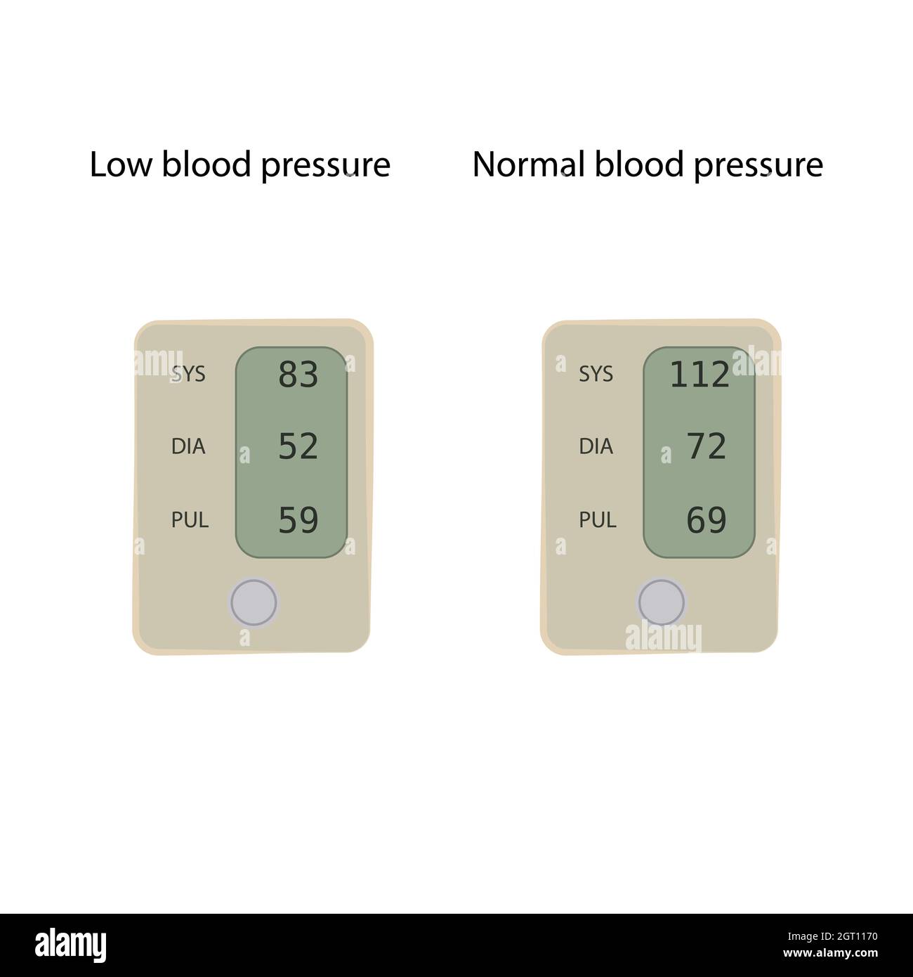 Presión arterial normal y baja, ilustración Fotografía de stock Alamy