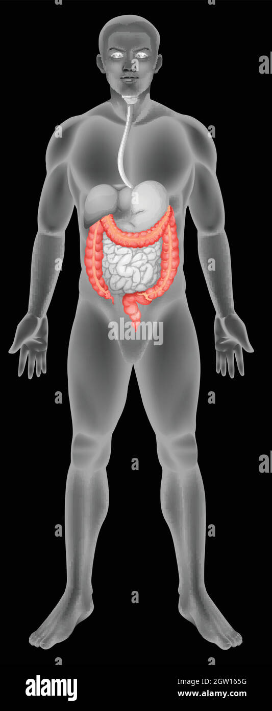 El intestino grueso Ilustración del Vector
