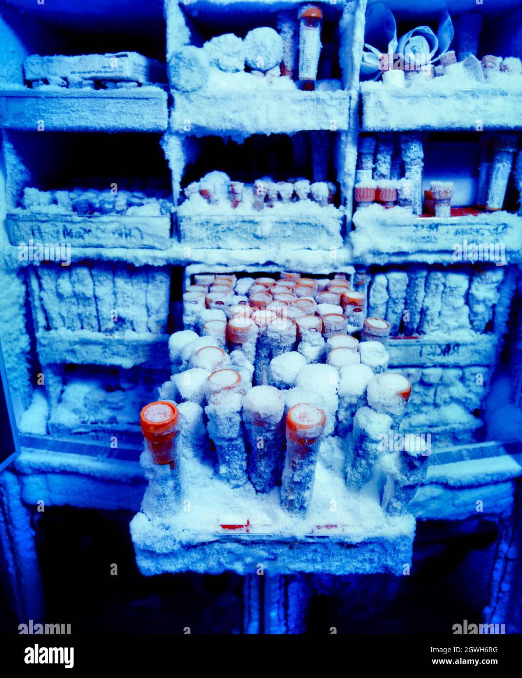 Muestras de sangre de investigación médica en congelador Foto de stock