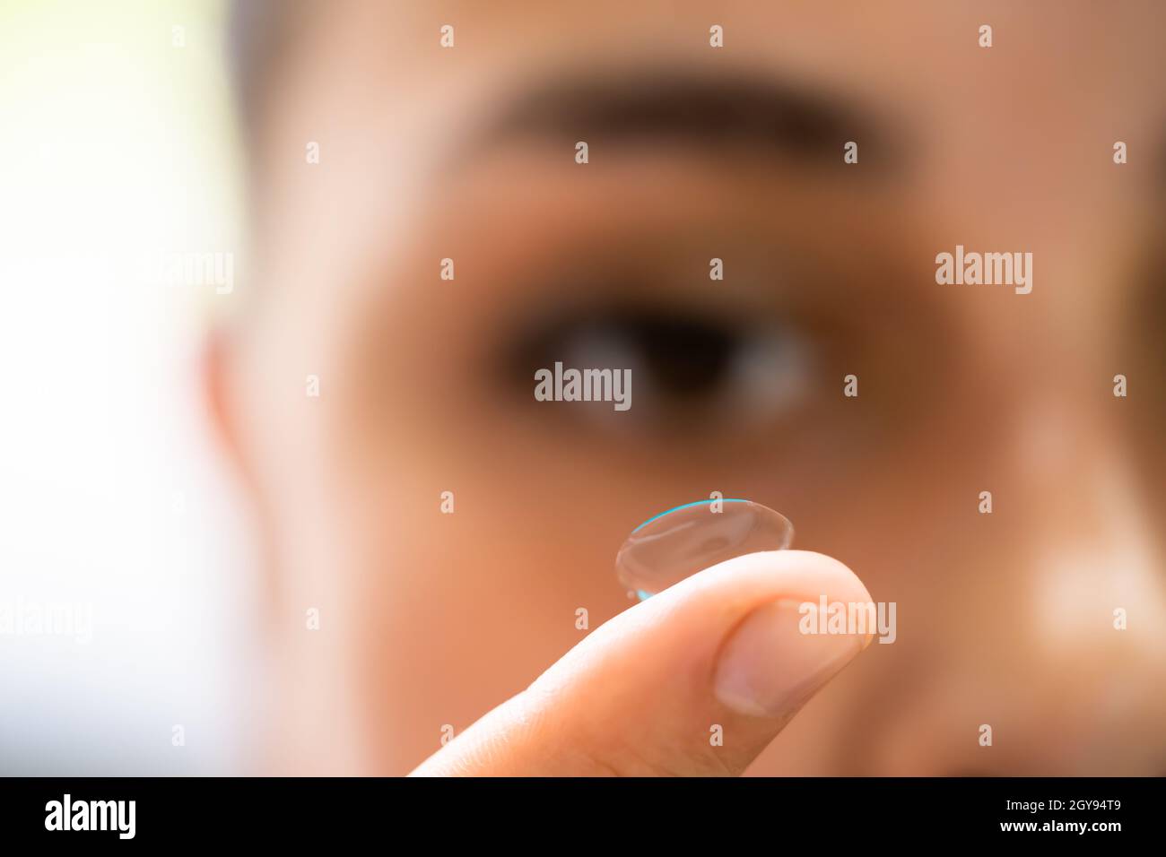 Inserción de la lente de contacto en el ojo. Oftalmología Ocular Foto de stock