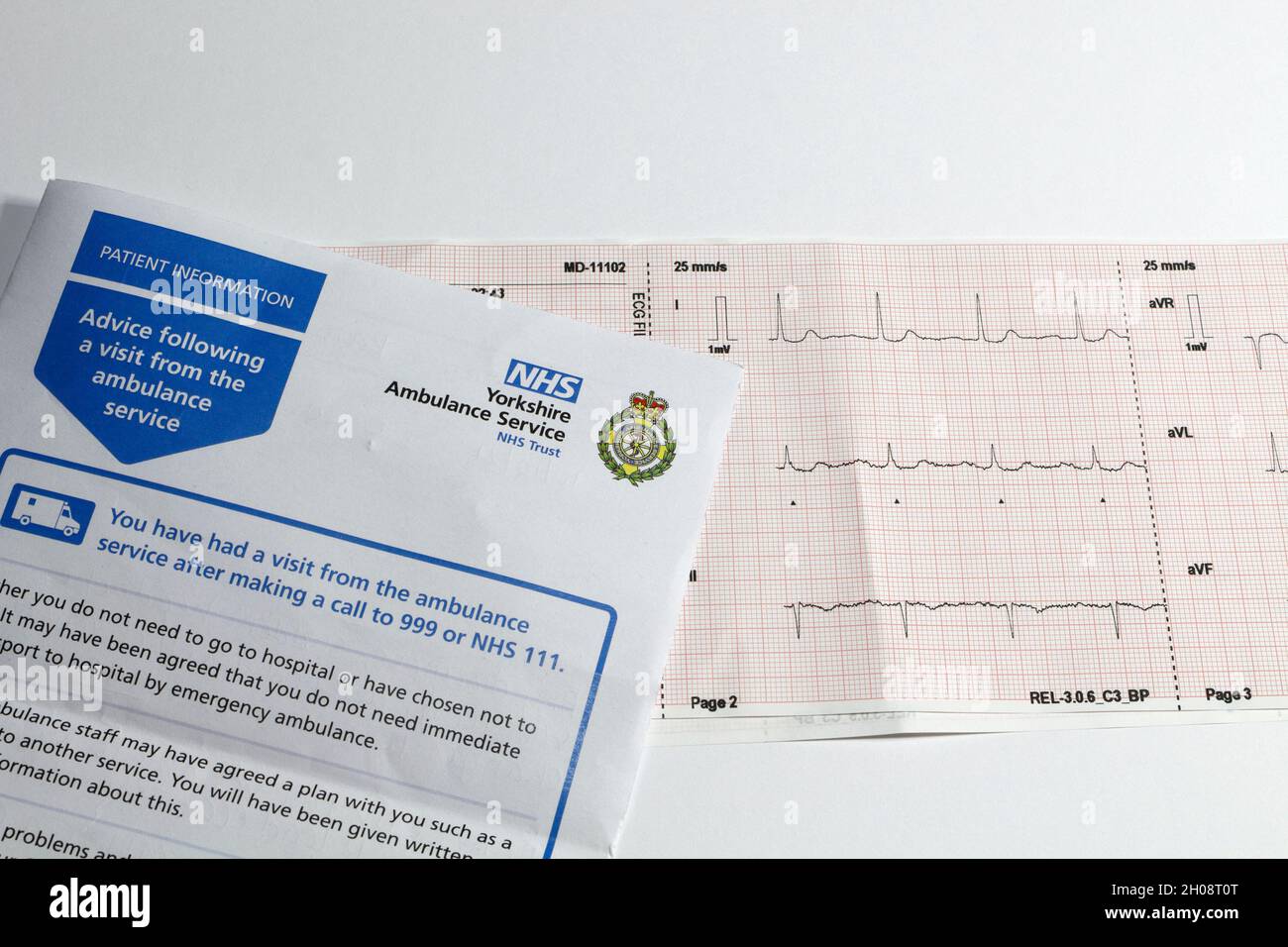 Impresión de ECG de una visita de paciente, por parte de los primeros intervinientes de ambulancia Foto de stock