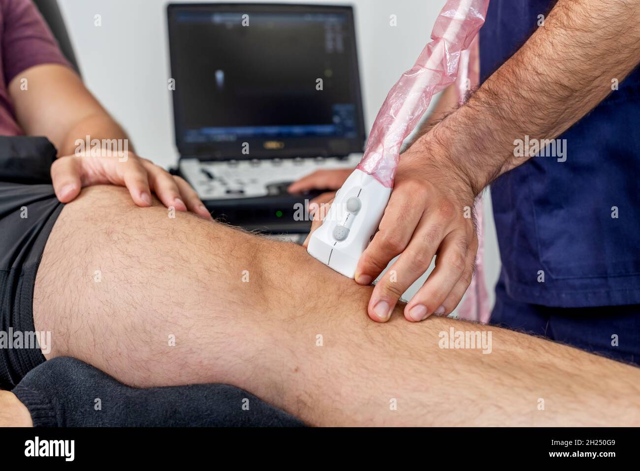 Primer plano de un fisioterapeuta que realiza una ecografía de la rodilla en un paciente tumbado en la camilla Foto de stock