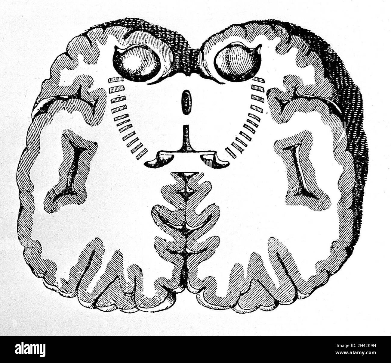 Corte coronal del cerebro fotografías e imágenes de alta resolución Alamy