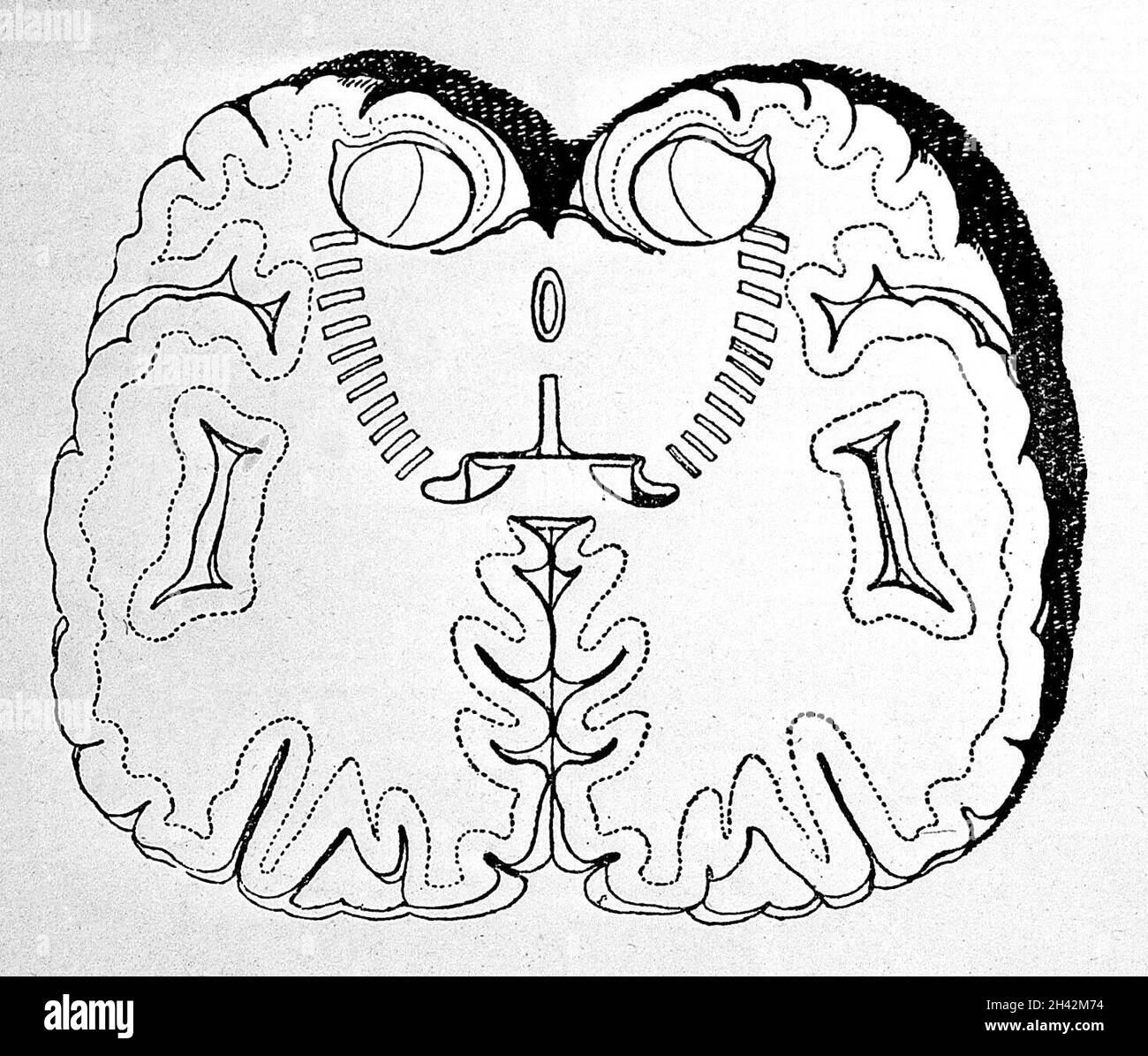 Corte coronal del cerebro fotografías e imágenes de alta resolución Alamy