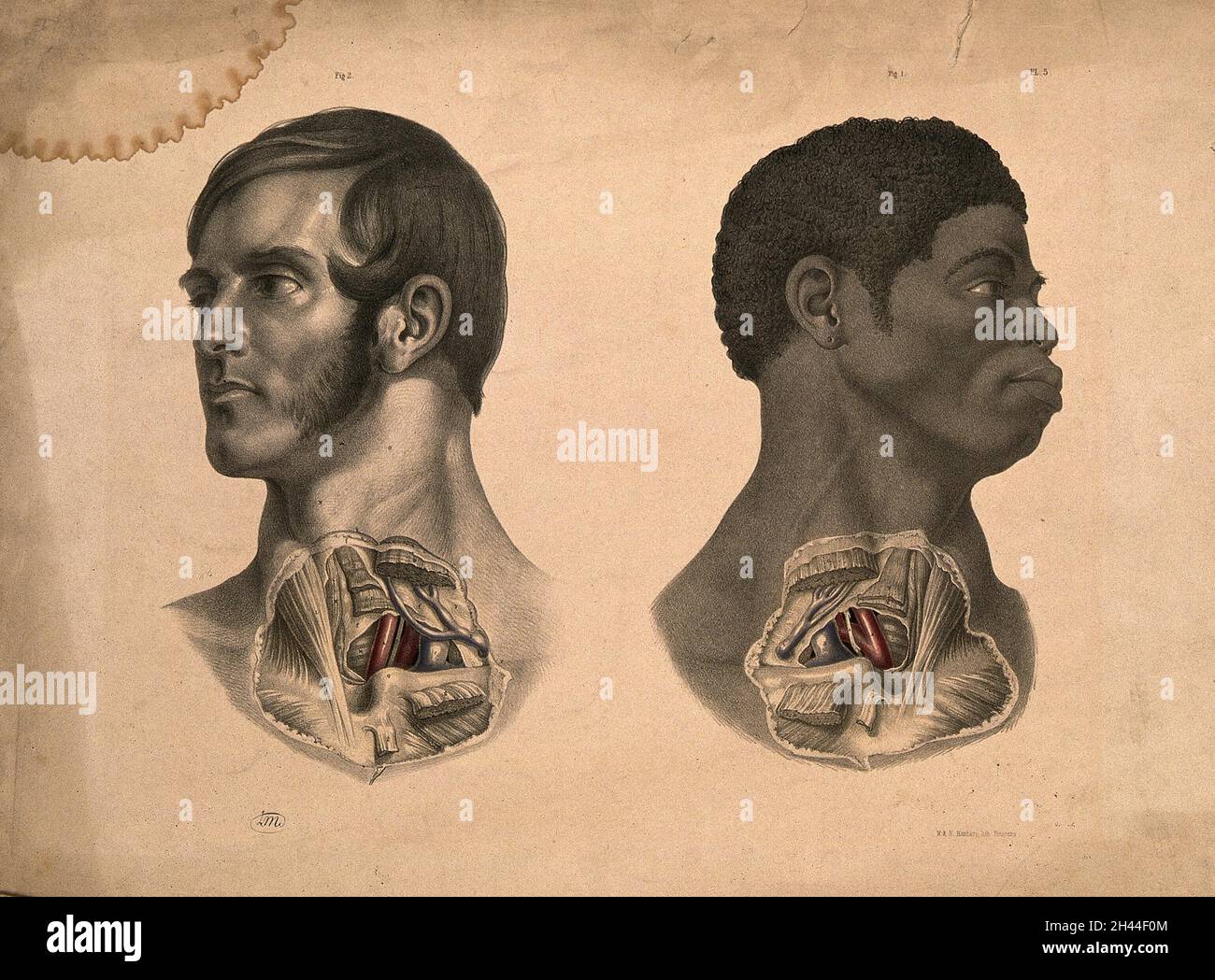 Dos cabezas de hombres (una blanca y otra negra africana), que muestran