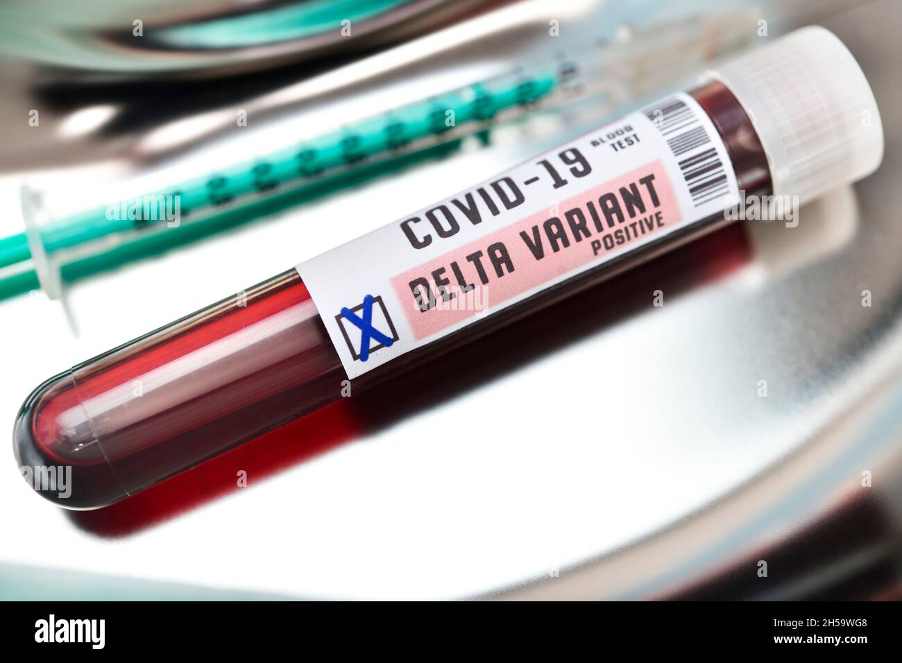 Blutprobe mit Coronavirus Delta-Variante B.1.617.2, Symbolfoto Foto de stock