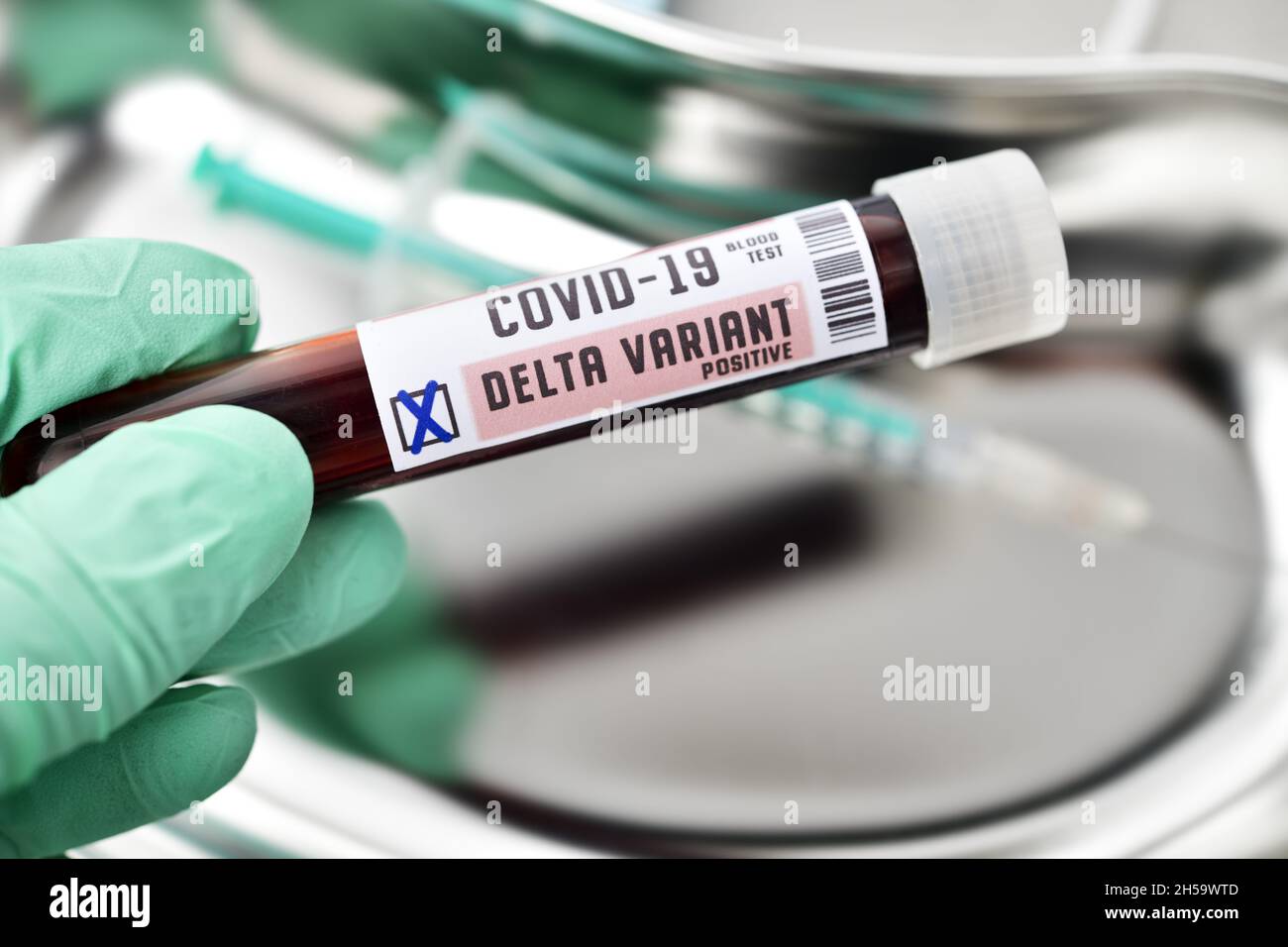 Blutprobe mit Coronavirus Delta-Variante B.1.617.2, Symbolfoto Foto de stock