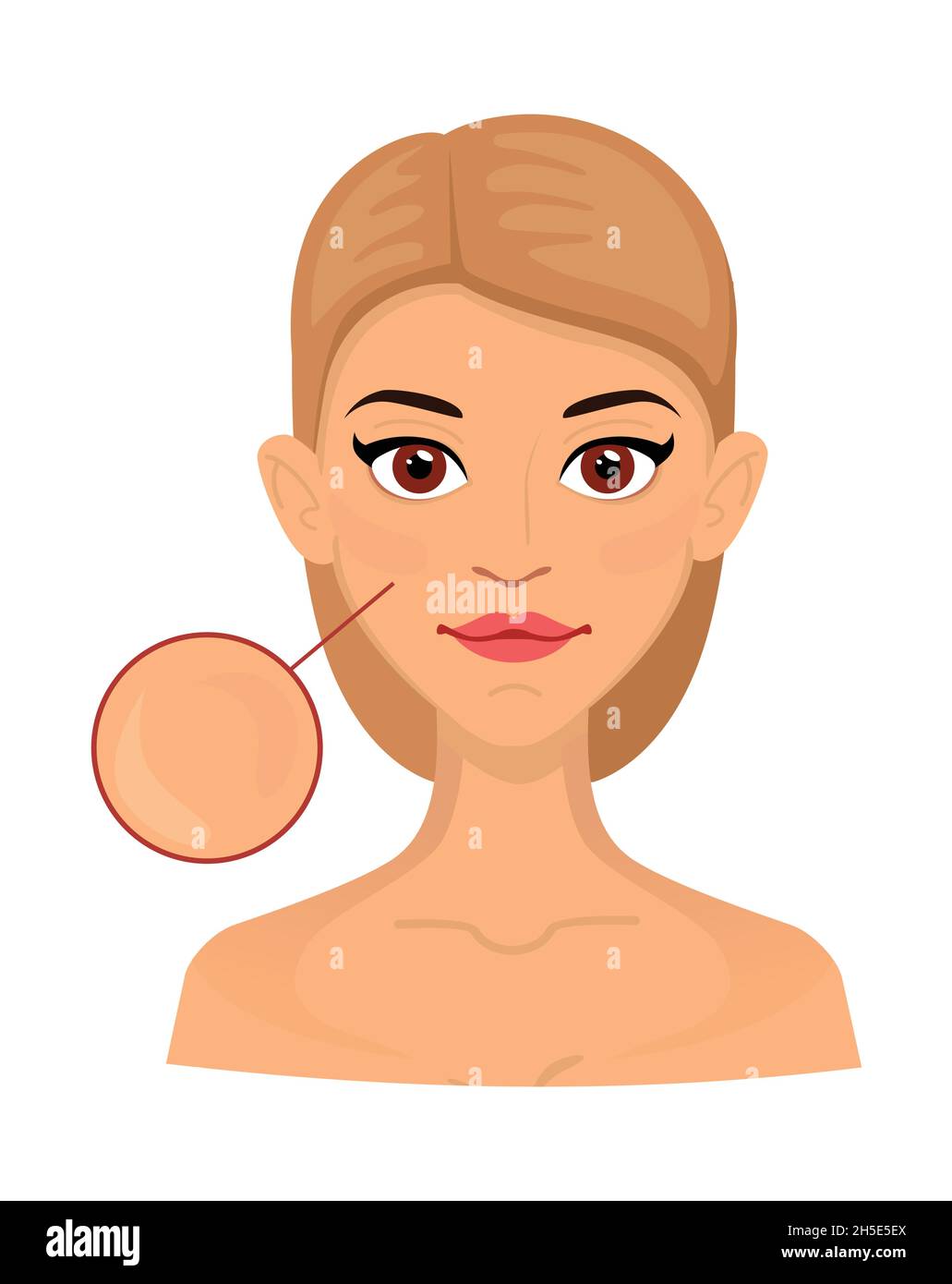 Mujer Diferentes tipos de piel normal, área agrandada para cosmetología. Acné, arrugas y manchas de edad. Ilustración del Vector