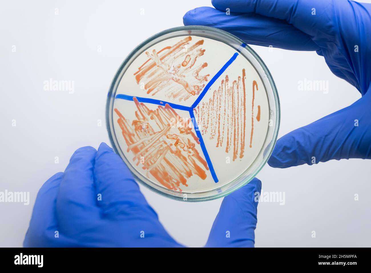 Una placa de Petri con colonias de bacterias de color naranja, las