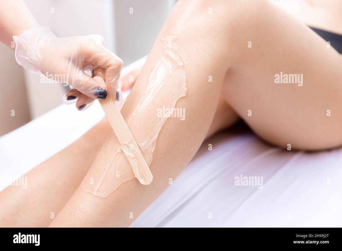 Primer plano zona de depilación láser piernas de la mujer elimina el pelo,  aplicación de gel Fotografía de stock - Alamy