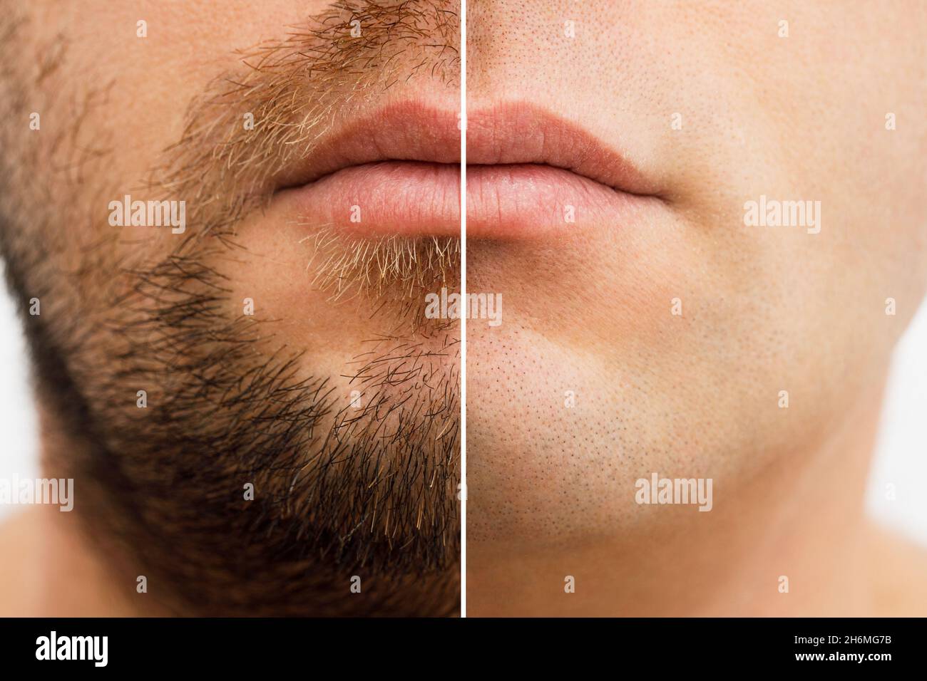 Primer plano foto de la cara de un hombre antes y después del afeitado. Un  hombre joven con barba. Comparación de la cara de un hombre con una barba y  sin barba.