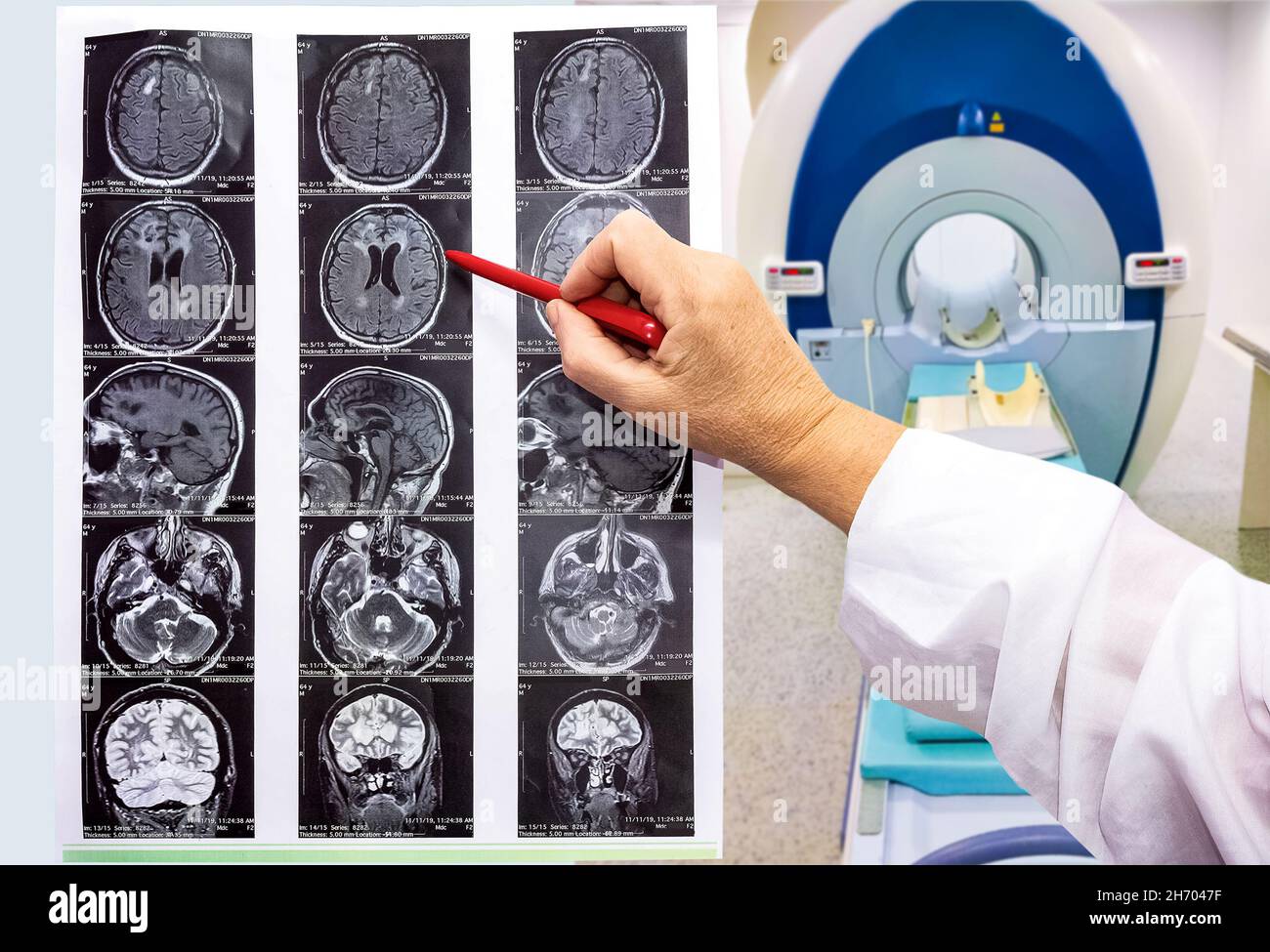 La imagen de resonancia magnética o resonancia magnética del cerebro masculino y la mano del médico Foto de stock