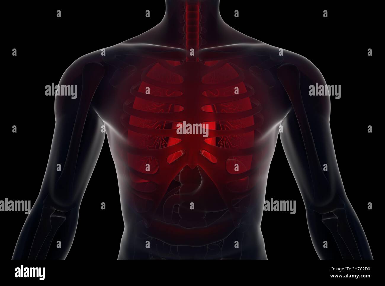 Pulmones humanos infectados. Ilustración 3D Foto de stock