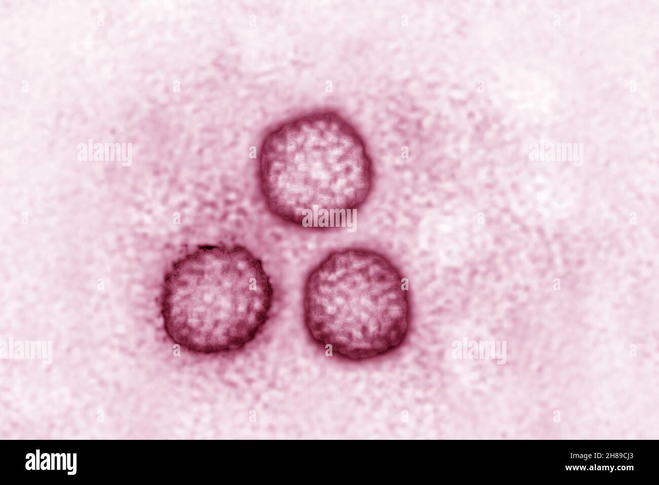 Virus del papiloma Foto de stock
