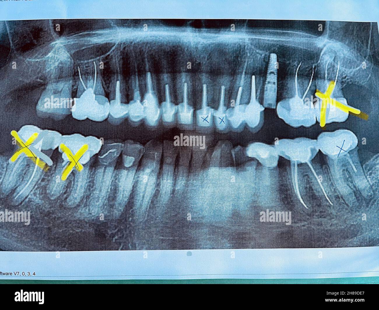 Dental panoramic fotografías e imágenes de alta resolución - Alamy