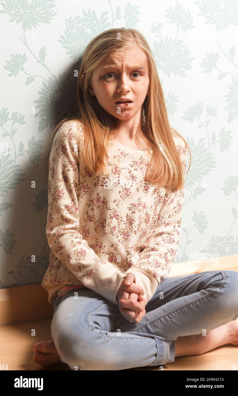 El abuso doméstico, el niño aterrorizado con lesiones físicas Foto de stock