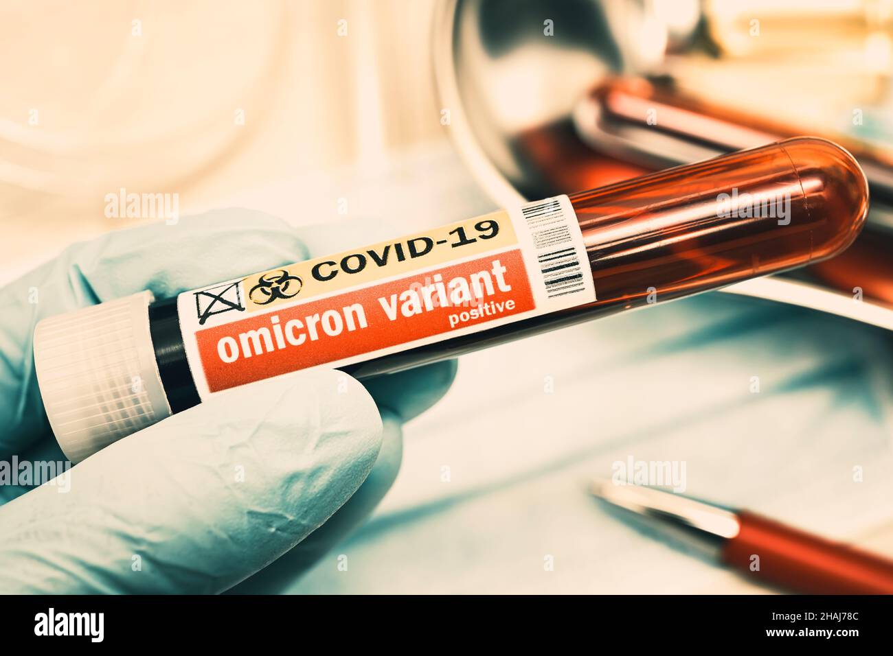 Tubo de análisis de sangre, variante de omicron B.1.1.529 Foto de stock