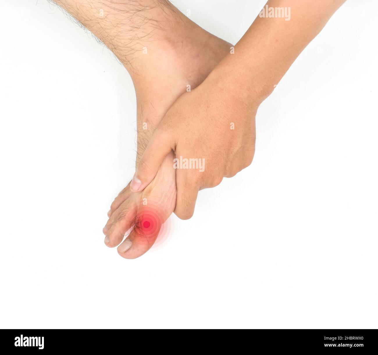 Inflamación del dedo gordo del pie del joven asiático. Concepto de dolor en  las articulaciones del pie, artritis, hiperuricema o gota. Aislado sobre  blanco Fotografía de stock - Alamy