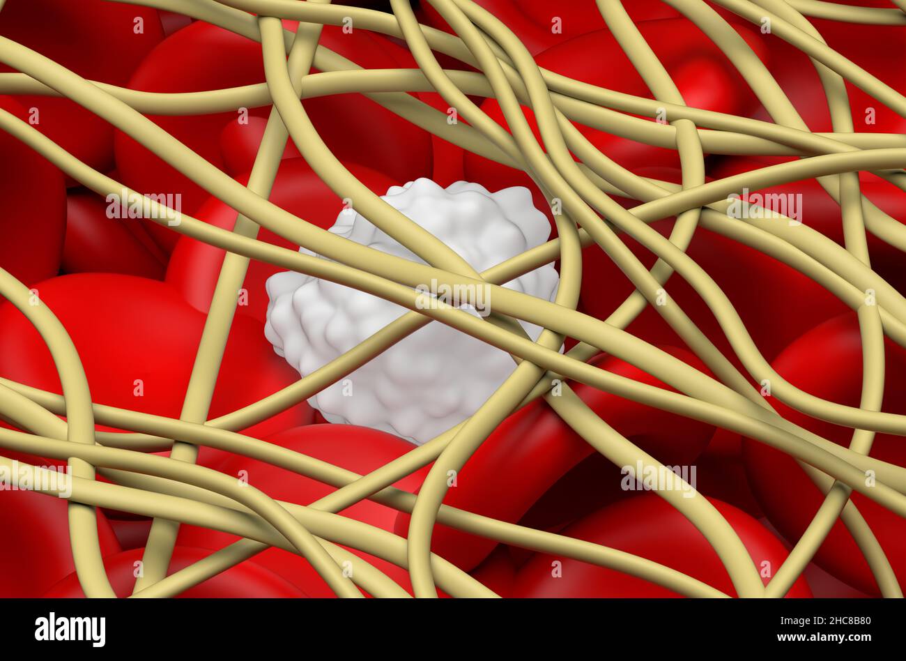 Coágulo de sangre. Los glóbulos rojos y un glóbulo blanco quedan atrapados en los filamentos de la proteína de fibrina. vista de cierre 3D ilustración Foto de stock