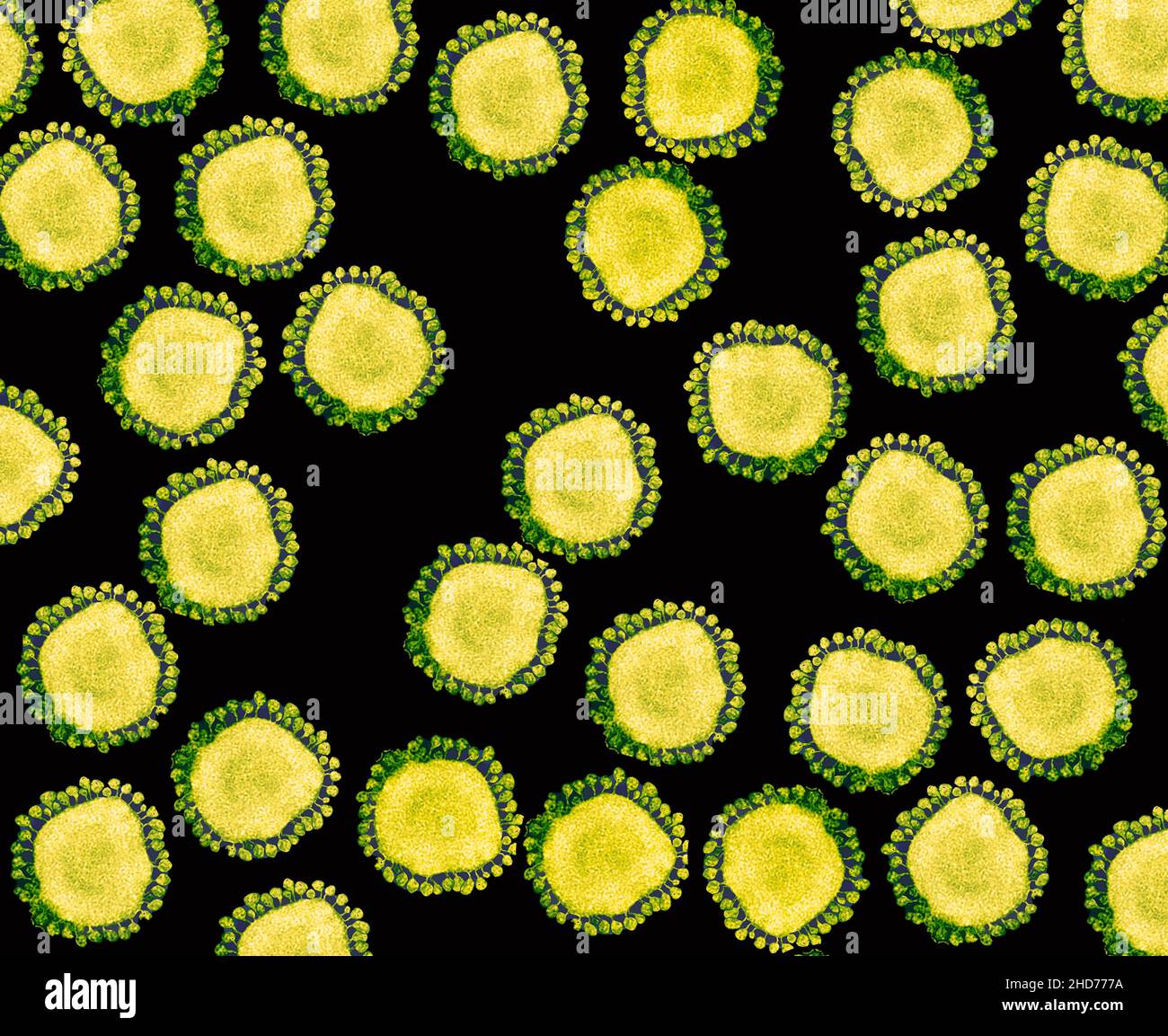 Partículas de Covid-19 de coronavirus purificadas bajo microscopía electrónica de transmisión (TEM). Foto de stock