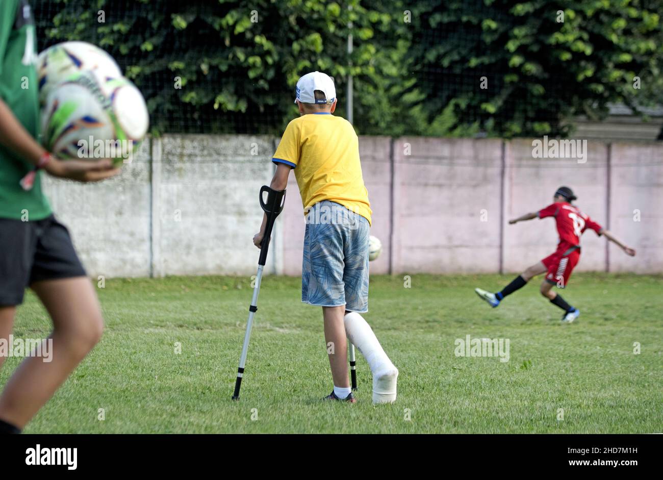 Niño con pierna en yeso después de una lesión de fútbol viendo a un compañero jugando Foto de stock