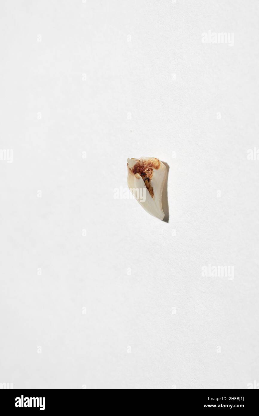 Diente de leche del bebé canino perdido con manchas de sangre en la parte superior de la raíz en el centro sobre fondo blanco. Cambio de los primeros dientes. Ir al dentista para hacer el diente Foto de stock