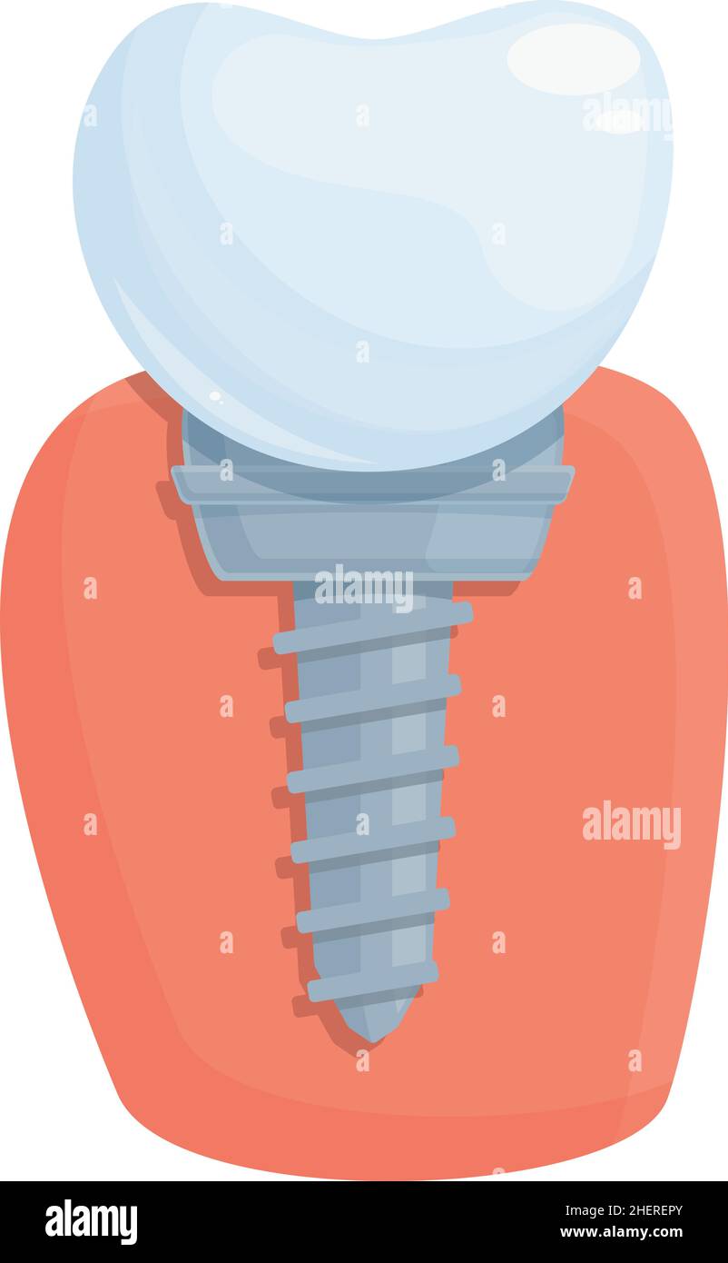 Procedimiento DIENTE IMPLANTE ICONO CARTOON Vector. Corona dental