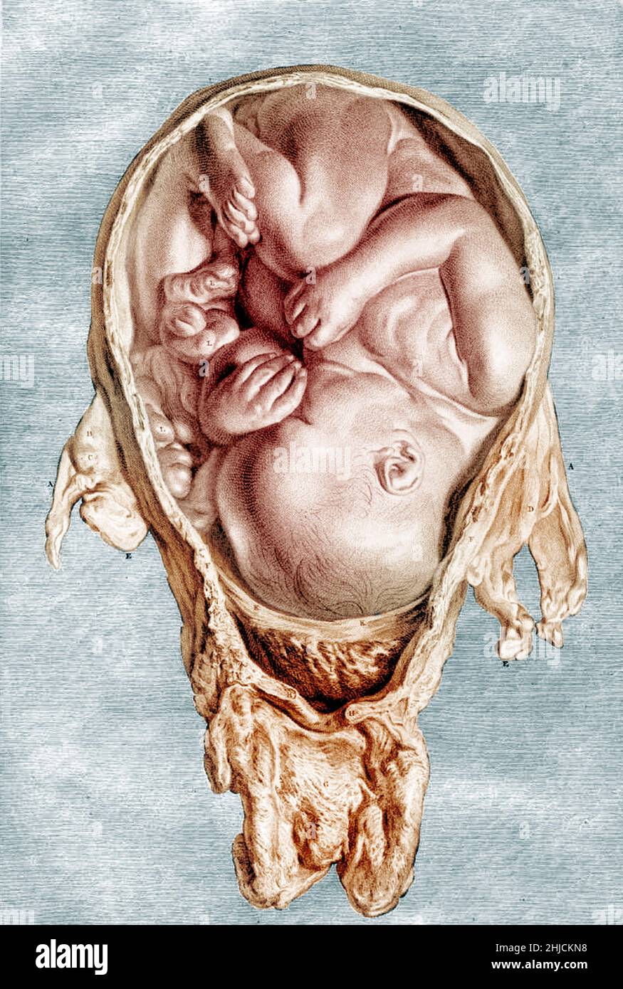 Tabla 12. William Hunter publicó numerosos artículos sobre la anatomía, cirugía y obstetricia, pero su obra más famosa fue la hermosa Anatomia uterino humani gravidi, o la anatomía del útero grávidas humano. En su prefacio, Hunter señala que muchos de los dibujos se preparó por primera vez en 1751. La mayoría de los dibujos fueron ejecutados por Jan van Rymsdyk, y un gran número de grabadores participaron en el proyecto. Impreso en Birmingham: John Baskerville, 1774. William Hunter (23 de mayo de 1718 - 30 de marzo de 1783) fue un anatomista escocés y médico. Hunter fue entrenado en anatomía en St George's Hospit Foto de stock