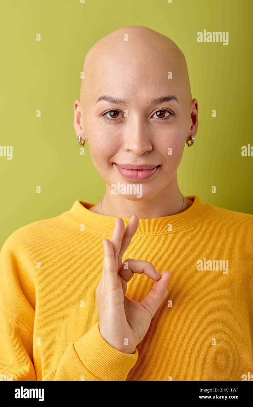 Sonriente joven calva modelo mujer sin pelo con camisa amarilla posando  aislado sobre fondo verde retrato estudio. Simulación de espacio de copia.  Mostrando OK est Fotografía de stock - Alamy