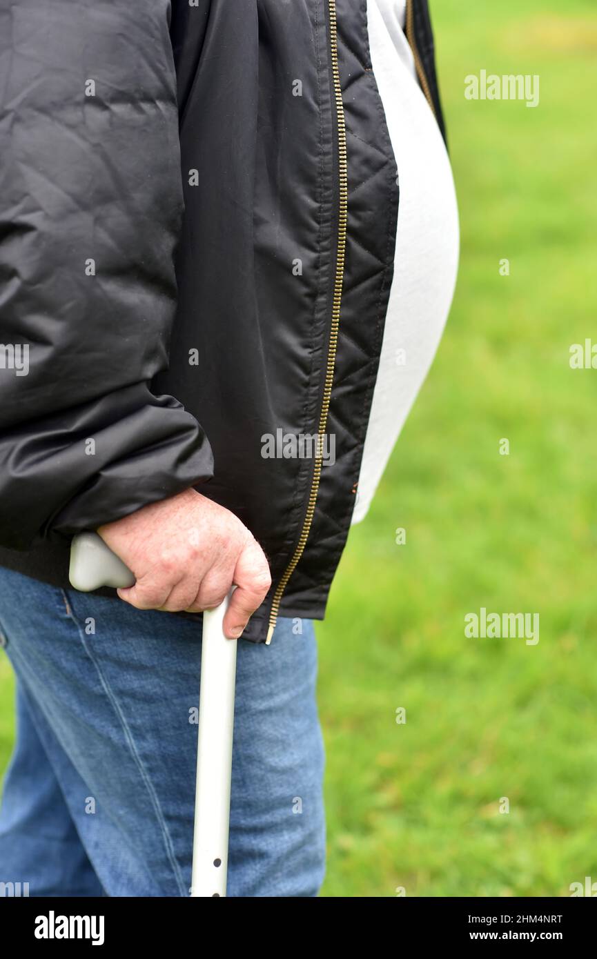 Hombre obeso con bastón de caminar, anónimo Foto de stock