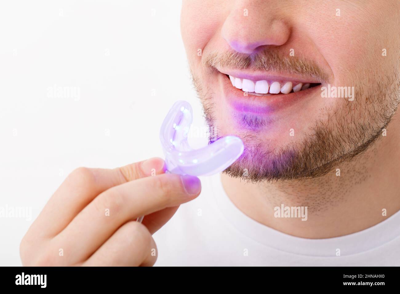 Un hombre sostiene en su mano una lámpara ultravioleta para blanquear los dientes caseros. Una sonrisa blanca de nieve después de blanquear. Foto de stock