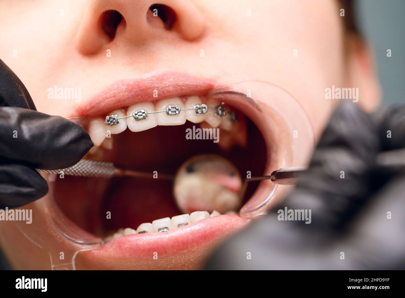 Brackets metalicos fotografías e imágenes de alta resolución - Página 5 -  Alamy