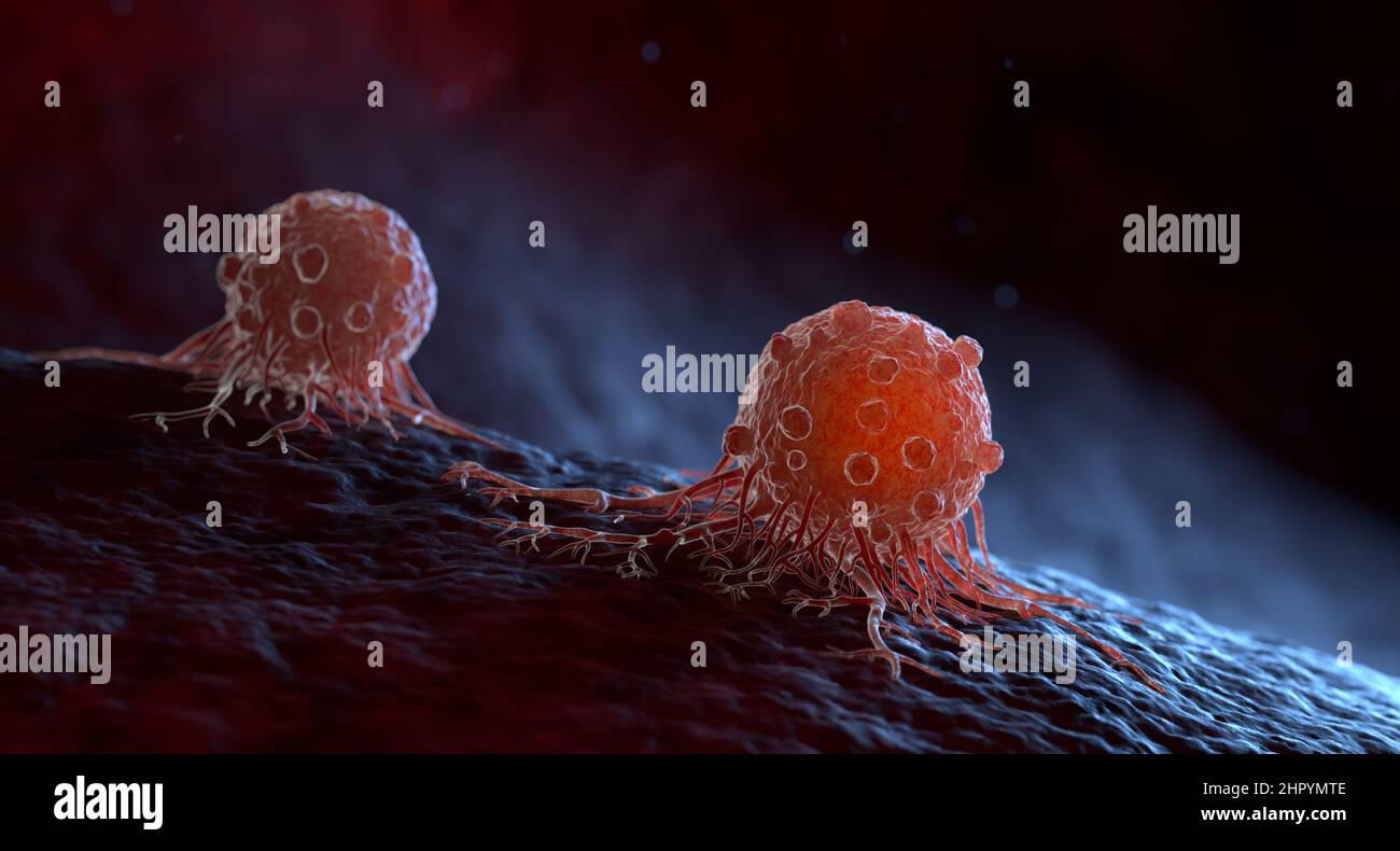 Las células cancerosas pueden migrar a otros tejidos corporales u órganos que construyen metástasis. Ilustración 3D Foto de stock