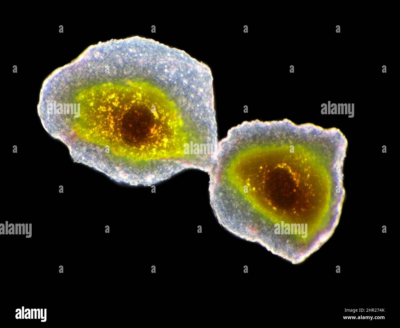 Células epiteliales de las mejillas humanas Bajo el microscopio, el campo de visión horizontal es de unos 125 micrómetros Foto de stock