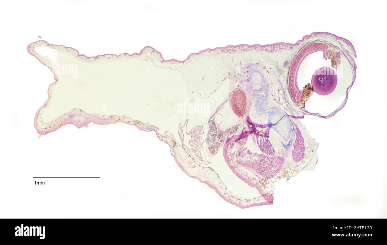 portaobjetos de histología de la aorta