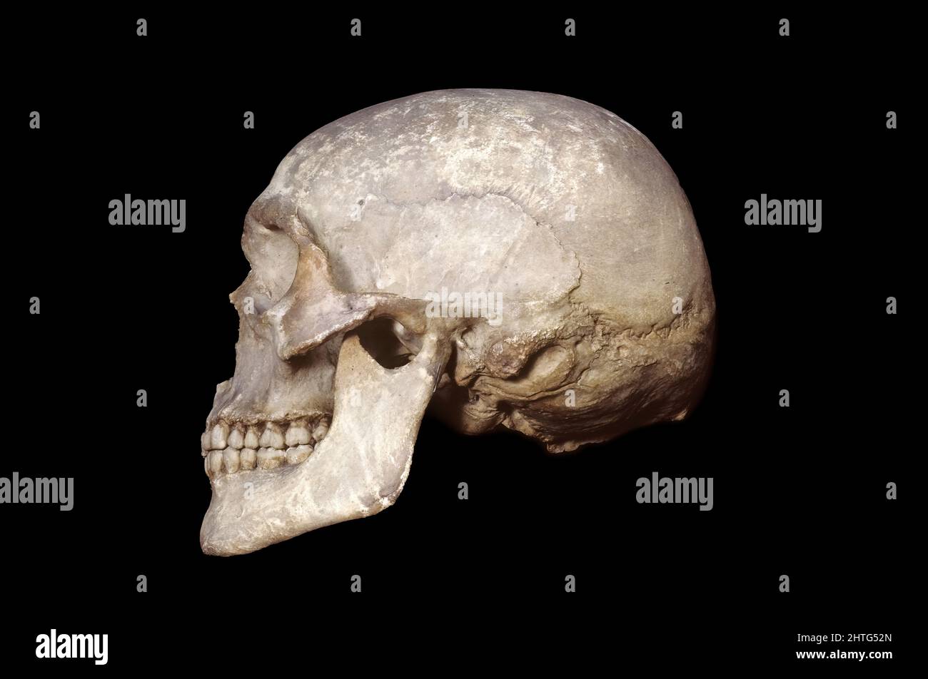 Cráneo macho caucásico Foto de stock