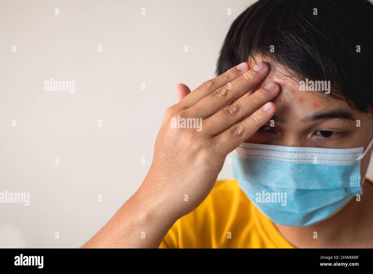 Allergic skin reactions fotografías e imágenes de alta resolución - Alamy