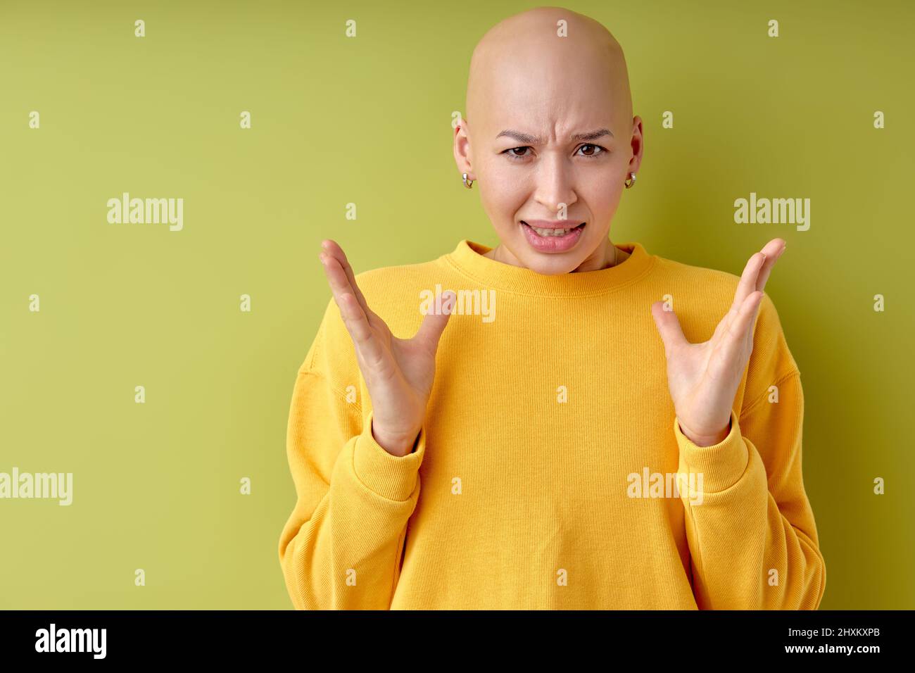 Mujer irritada en camisa amarilla casual discutiendo mirando la cámara, aislada sobre fondo verde del estudio. Retrato de una mujer calva sin vello que gestora, hav Foto de stock