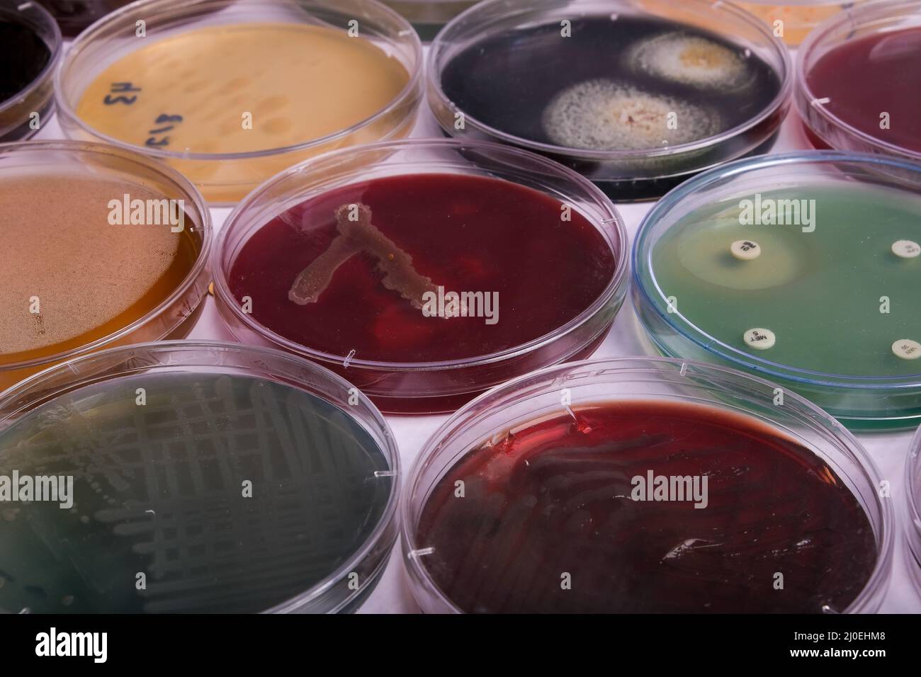 la recogida de placas de cultivo contiene el crecimiento de microorganismos  en diferentes medios de agar Fotografía de stock - Alamy